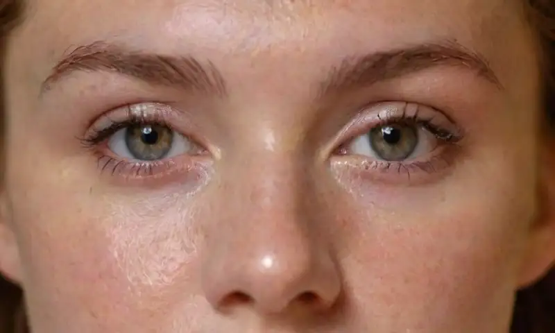 El primer plano de una joven muestra su piel radiante con granos rojos, pecas sutiles, ojos avellana y hasta productos de cuidado sobre una mesa, todo iluminado con luz natural
