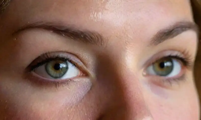 Un primer plano del rostro de una persona con piel delicada