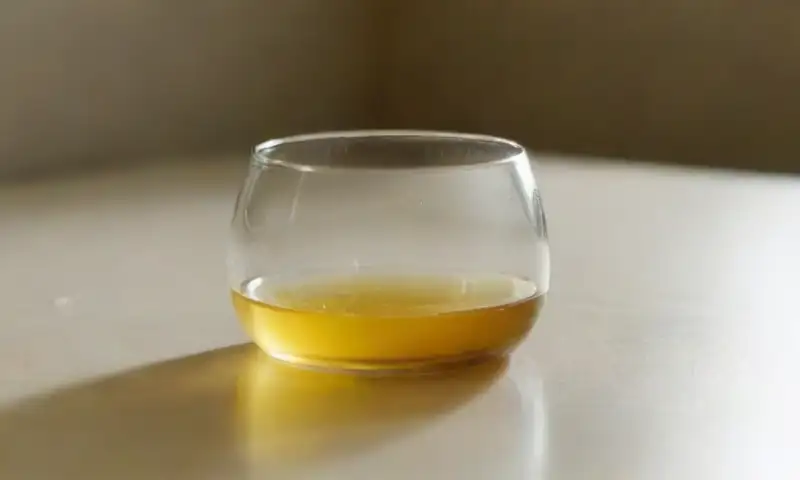 Un recipiente de vidrio lleno de orina refleja luz y muestra burbujas y gotas en un entorno clínico