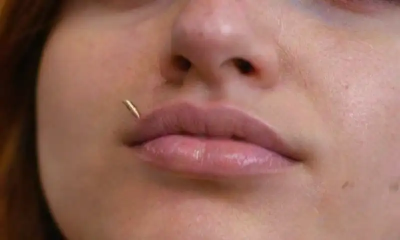 Primer plano de un piercing en el septum infectado