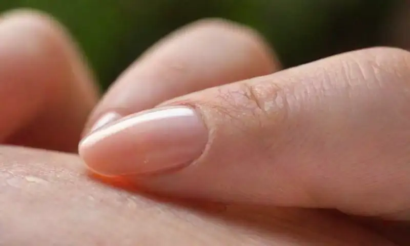 Primer plano de una mano con dedos alargados, uñas bien cuidadas, y detalles que destacan su textura y salud en un ambiente suave y sereno